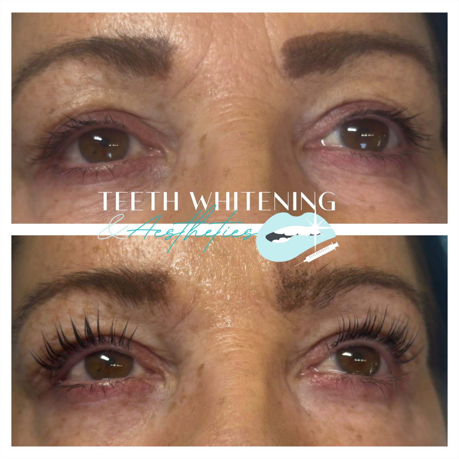 LVL lash lift treatment result